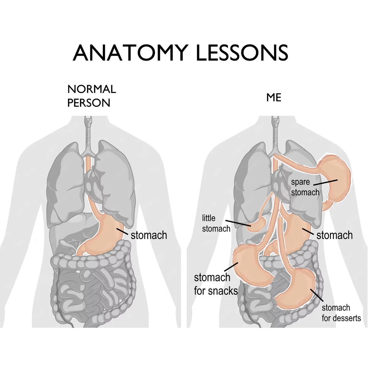 The image shows two human torso diagrams under 'ANATOMY LESSONS'. The left side, labeled 'NORMAL PERSON', has one labeled…