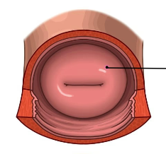 Cervix vs. Emoji: A Lighthearted Debate