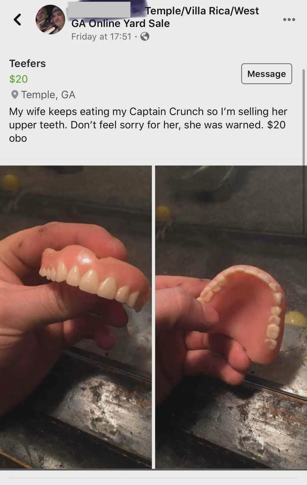 A screenshot of a Facebook Marketplace listing shows a person selling a set of upper dentures for $20, with the listing text…