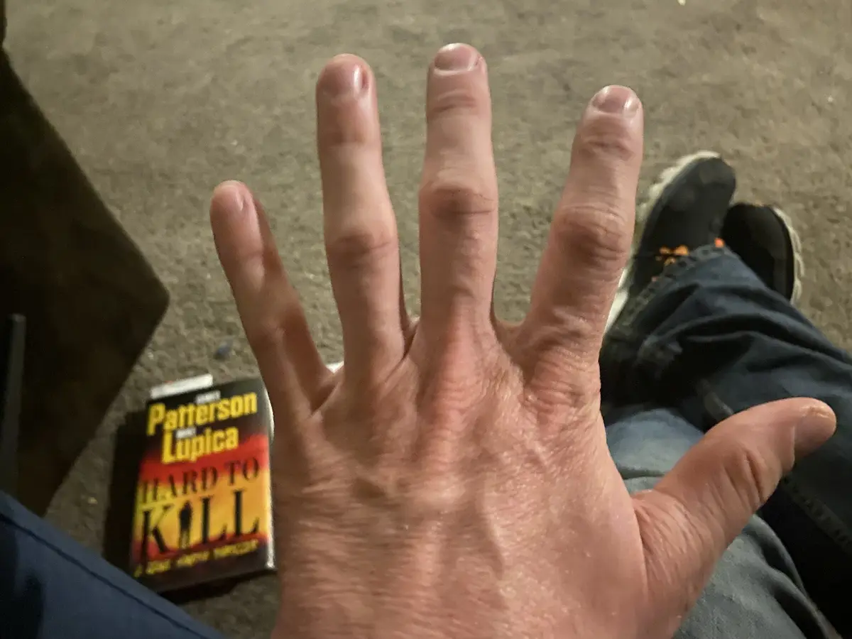 A close-up photo shows a person's open palm with all five fingers extended, positioned in front of a carpeted floor. In the…