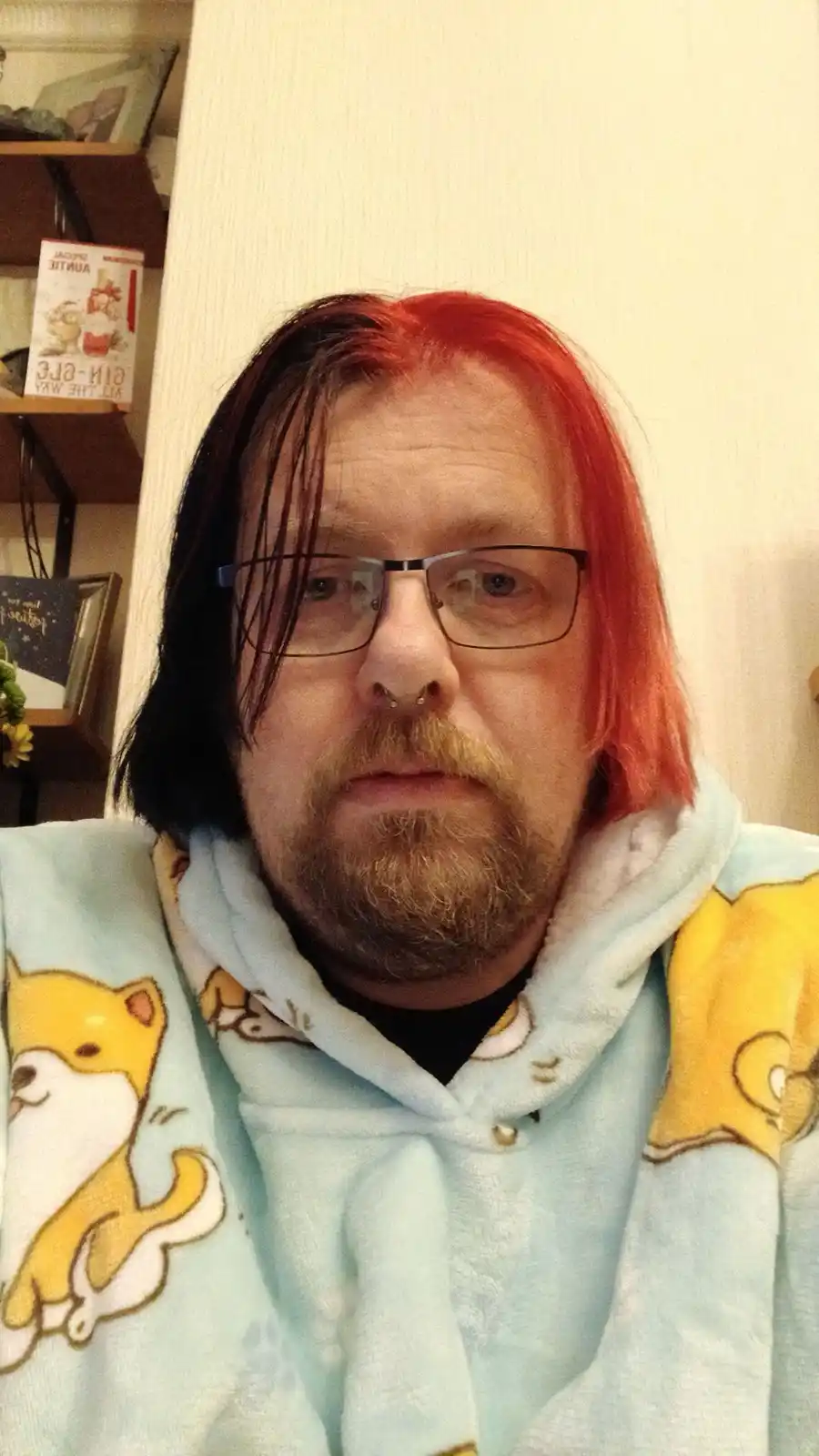 A man with half-black, half-red dyed hair, wearing glasses and a light blue hoodie with cartoon dogs, stares blankly at the…