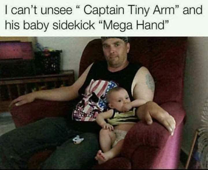 A man with a visibly small, stubby right arm sits in a red armchair holding a baby. The baby, sitting on his lap, has an…